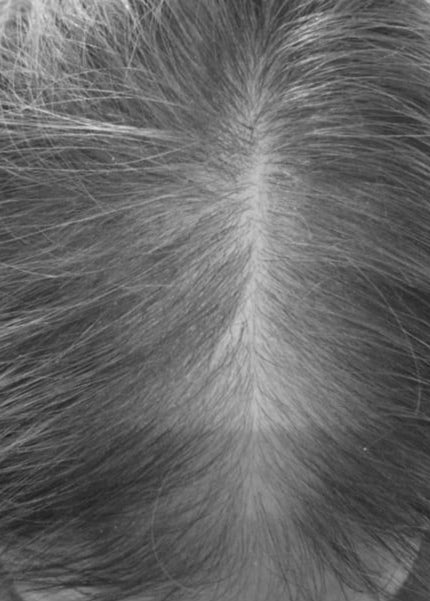 image comparison after
