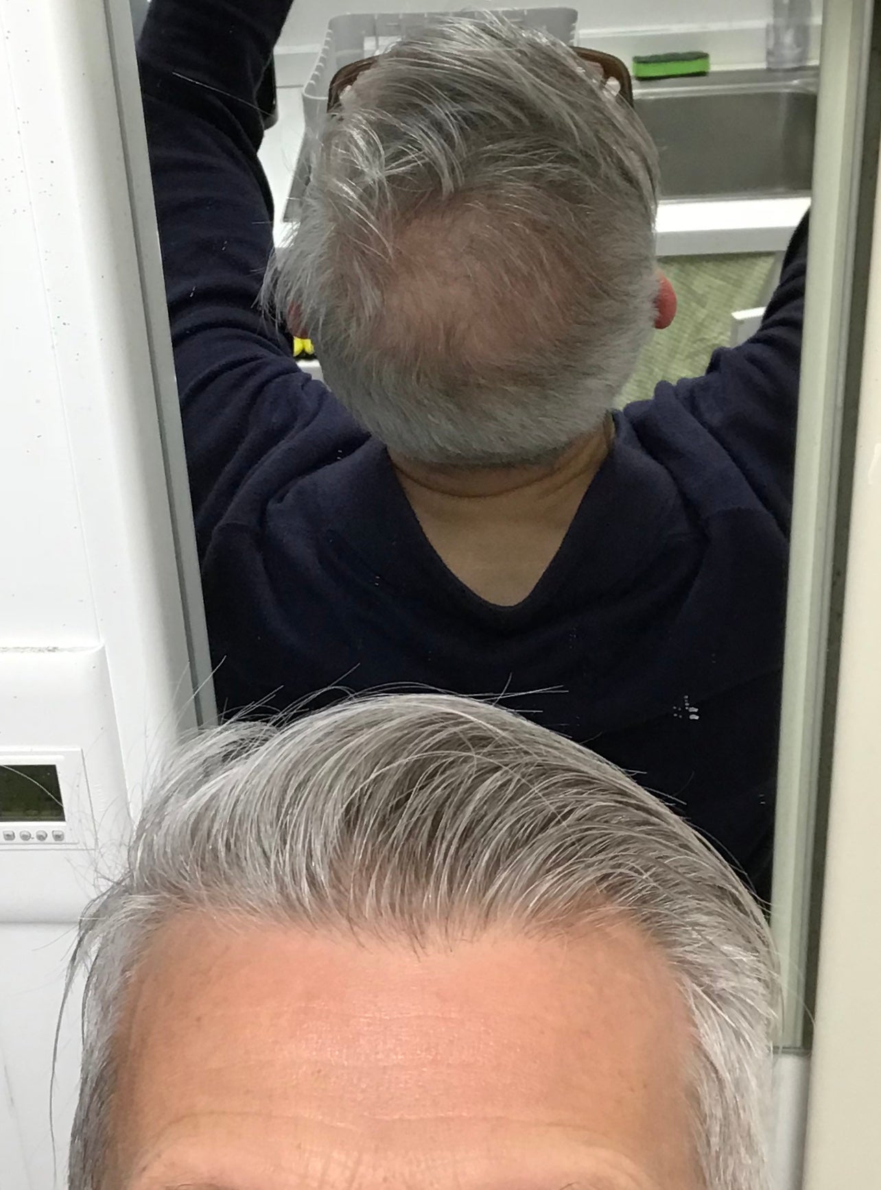 image comparison before