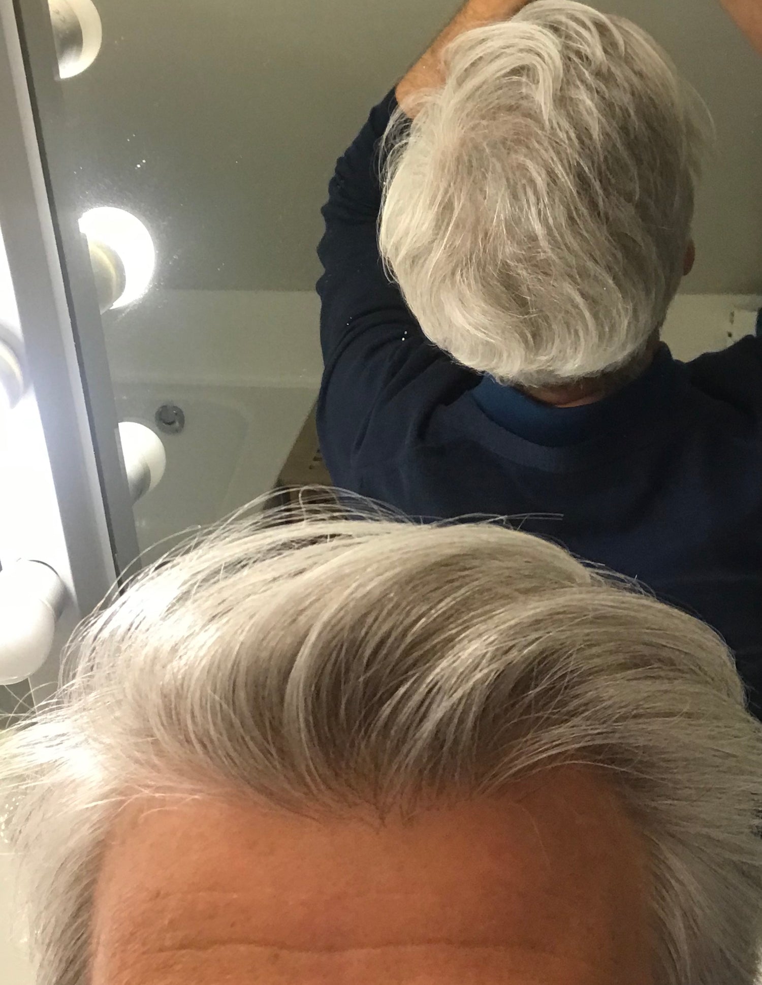 image comparison after