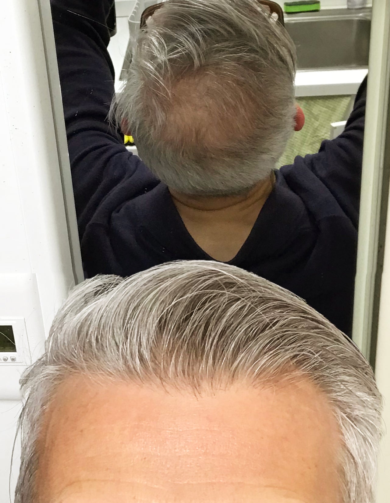 image comparison before