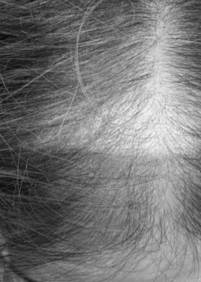 image comparison before