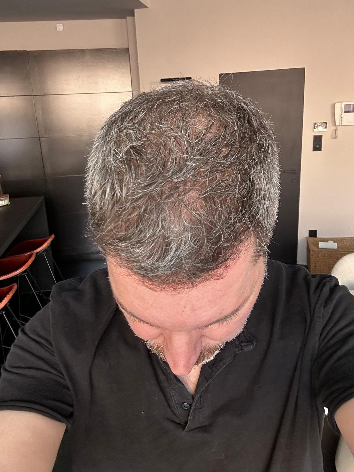 image comparison after