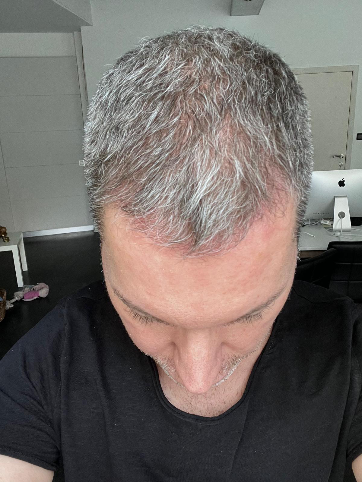image comparison before